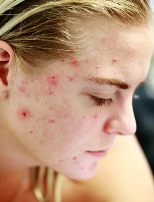 streptomyces avermitilis